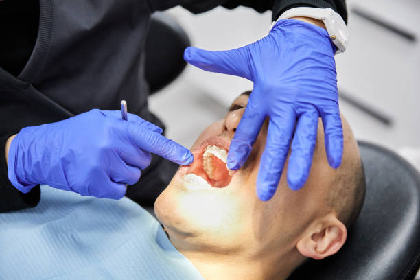 Best Emergency Tooth Extraction in Spartanburg, SC