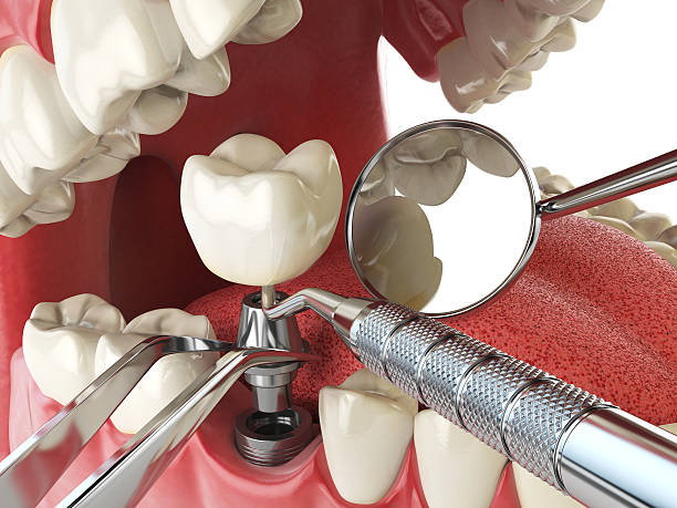 Best Cosmetic Emergency Dentistry in Spartanburg, SC